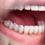 Dr Vigneron dents chirurgie